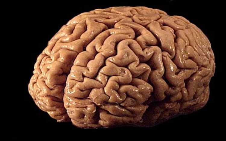 Bőrsejtekből fejlesztettek emberi agymodellt
